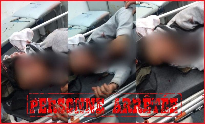 توضيح بشأن مقطع فيديو يظهر فيه شخص يحمل جروحا بالرأس